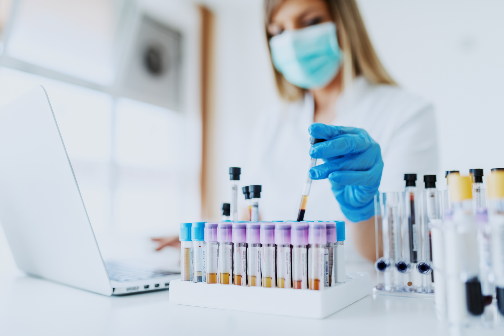 test tubes with drawn blood